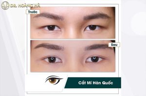 cat-mi-mat-duy-tri-duoc-bao-lau