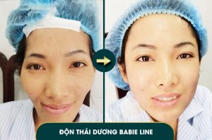 review-don-thai-duong