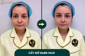 cay-mo-ma