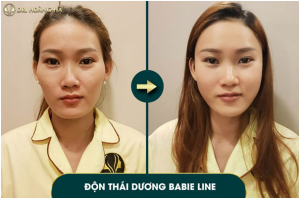 khach-hang-don-thai-duong