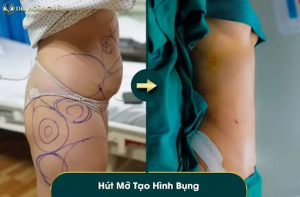 hut-mo-bung